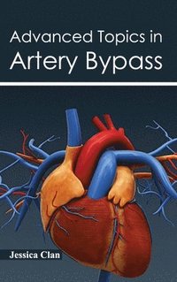 bokomslag Advanced Topics in Artery Bypass