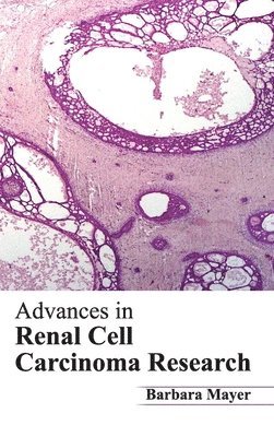 Advances in Renal Cell Carcinoma Research 1