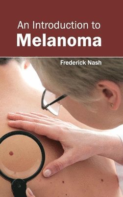 Frederick Nash - Introduction to Melanoma, Inbunden