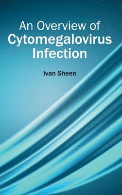 bokomslag Overview of Cytomegalovirus Infection