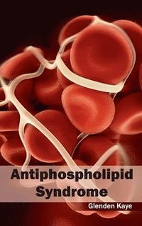 bokomslag Antiphospholipid Syndrome