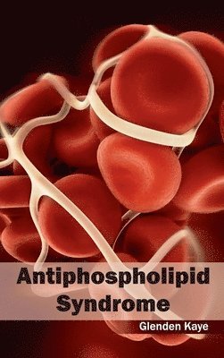 bokomslag Antiphospholipid Syndrome