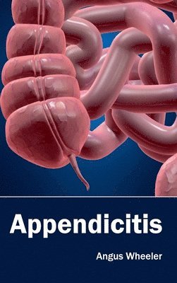 Appendicitis 1