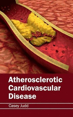 bokomslag Atherosclerotic Cardiovascular Disease