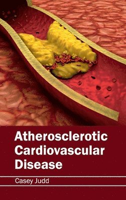 Atherosclerotic Cardiovascular Disease 1