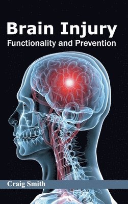 Brain Injury: Functionality and Prevention 1