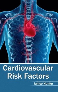 bokomslag Cardiovascular Risk Factors