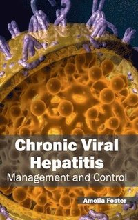 bokomslag Chronic Viral Hepatitis: Management and Control