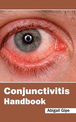 bokomslag Conjunctivitis Handbook