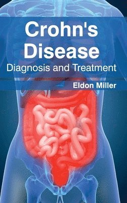 bokomslag Crohn's Disease: Diagnosis and Treatment