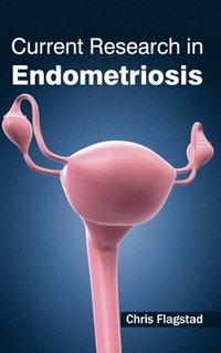 bokomslag Current Research in Endometriosis