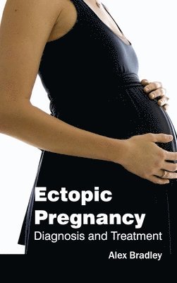 Alex Bradley - Ectopic Pregnancy: Diagnosis and Treatment, Inbunden