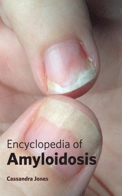 Encyclopedia of Amyloidosis 1