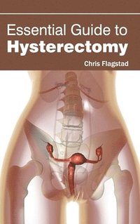 bokomslag Essential Guide to Hysterectomy