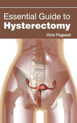 Essential Guide to Hysterectomy 1