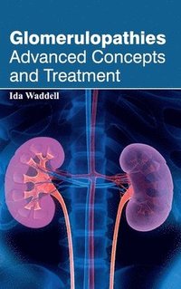 bokomslag Glomerulopathies: Advanced Concepts and Treatment