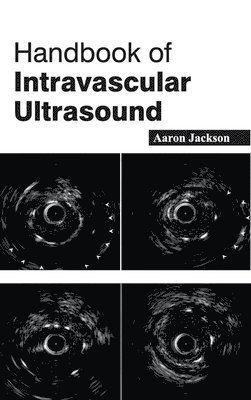 Handbook of Intravascular Ultrasound