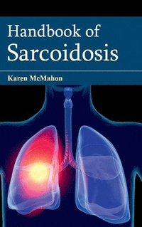 bokomslag Handbook of Sarcoidosis