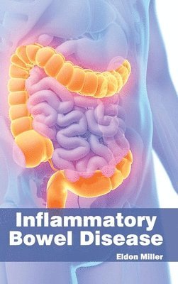 bokomslag Inflammatory Bowel Disease