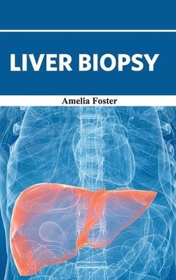 bokomslag Liver Biopsy