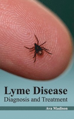 bokomslag Lyme Disease: Diagnosis and Treatment