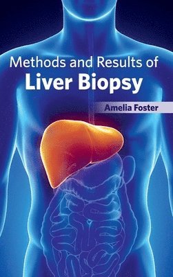 bokomslag Methods and Results of Liver Biopsy