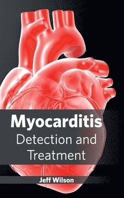 Myocarditis: Detection and Treatment 1