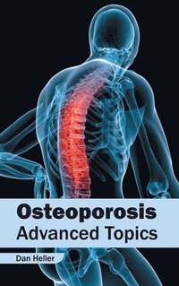 bokomslag Osteoporosis: Advanced Topics