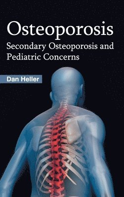 bokomslag Osteoporosis: Secondary Osteoporosis and Pediatric Concerns