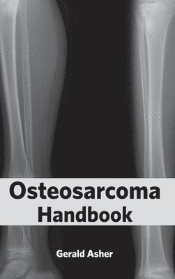 Osteosarcoma Handbook 1