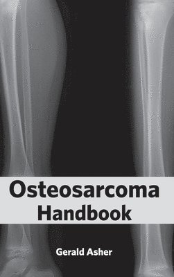 Gerald Asher - Osteosarcoma Handbook, Inbunden