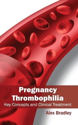 Alex Bradley - Pregnancy Thrombophilia: Key Concepts and Clinical Treatment, Inbunden