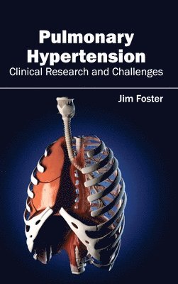 Jim Foster - Pulmonary Hypertension - Clinical Research and Challenges, Inbunden