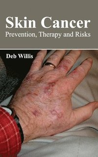 bokomslag Skin Cancer: Prevention, Therapy and Risks