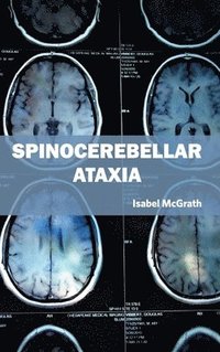 bokomslag Spinocerebellar Ataxia