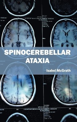 Spinocerebellar Ataxia 1