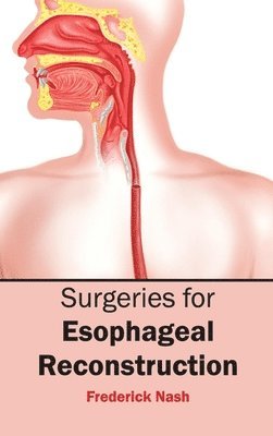 Frederick Nash - Surgeries for Esophageal Reconstruction, Inbunden
