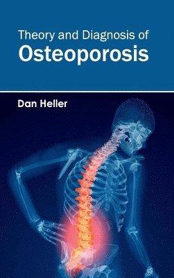 bokomslag Theory and Diagnosis of Osteoporosis