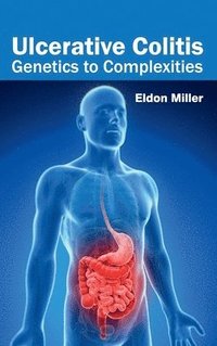 bokomslag Ulcerative Colitis: Genetics to Complexities