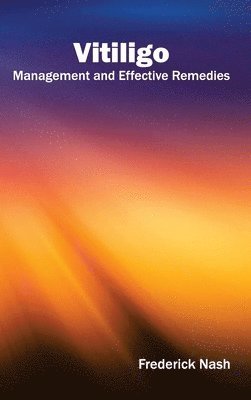 Frederick Nash - Vitiligo: Management and Effective Remedies, Inbunden