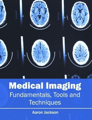 Medical Imaging: Fundamentals, Tools and Techniques 1