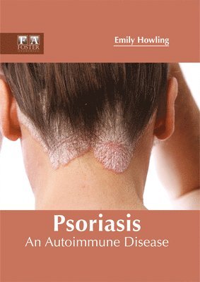 bokomslag Psoriasis: An Autoimmune Disease