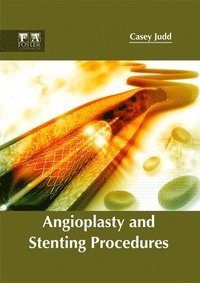 bokomslag Angioplasty and Stenting Procedures