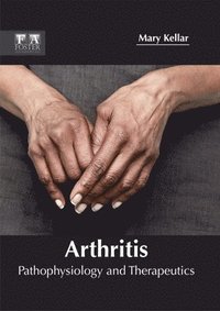 bokomslag Arthritis: Pathophysiology and Therapeutics