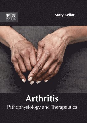 Arthritis: Pathophysiology and Therapeutics 1