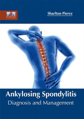 bokomslag Ankylosing Spondylitis: Diagnosis and Management