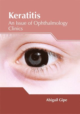 Keratitis: An Issue of Ophthalmology Clinics 1