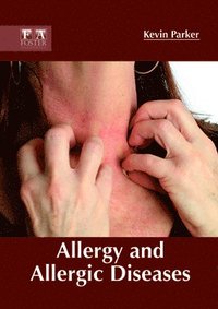 bokomslag Allergy and Allergic Diseases