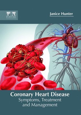 Coronary Heart Disease: Symptoms, Treatment and Management 1