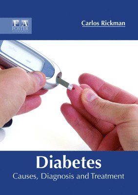 Carlos Rickman - Diabetes: Causes, Diagnosis and Treatment, Inbunden